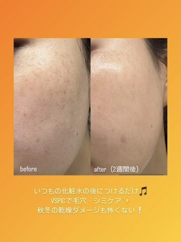 アローナ(ARONA)/spicare正規取扱店です！