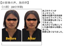 江坂回復アップラボ/お客様の声、施術例
