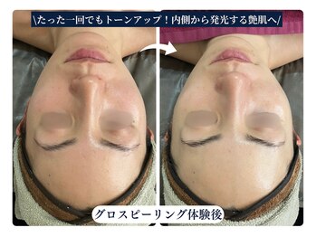 ザ ラウラ ビューティー フェイシャル(THE LAULA BEAUTY)