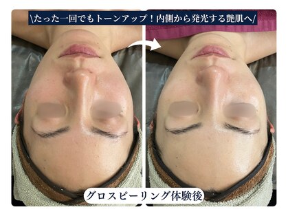 ザ ラウラ ビューティー フェイシャル(THE LAULA BEAUTY)の写真