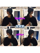 エリシオン(ELYSION)/整体ビフォーアフター