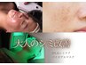 【シミ】徹底改善フェイシャル　コース　