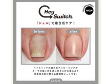 エイドクルール(AIDE couleur)