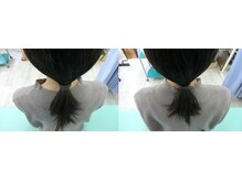 宮崎整体院/施術後3
