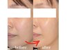 【肌育/ツヤ肌】ララピール超え!第5世代「DactorPeel(ダクトピール)」