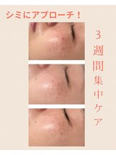 ヴィヴ コレビ(VIV COREBI)/お急ぎケア