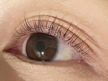 ノア(NOA)の写真/カウンセリング重視◎目やまぶたのお悩み、クセや状態など何でもご相談ください♪なりたい目元を叶えます★