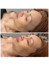 スリーズララ(Cerise La La)/