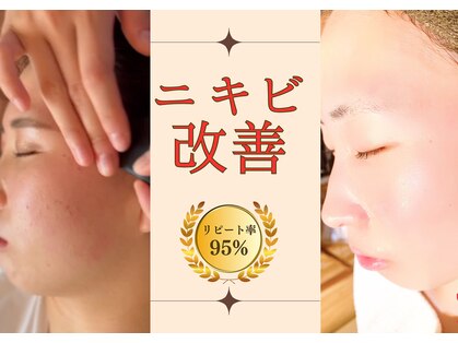 レフアの写真