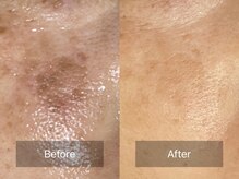 ピー ブリエ 弥富本店/ビフォーアフター