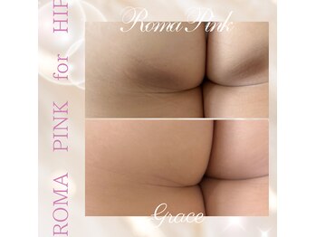 グレイス(Grace)/ローマピンク【ヒップ】