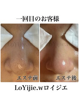 ロイジエ(Loyijie.w)/毛穴エステ