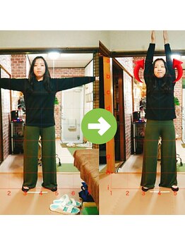 サプライズ整体院/30代ママさんの肩こり初回結果