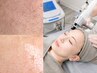 １度でツヤ肌ＷＡＸ脱毛（顔全体）＆美容液導入【たるみ改善・ハリ艶・毛穴】