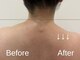 ナチュラ(natura)の写真/ゴリゴリの疲れとむくみに◎とろける極上デトックスで心も体も満たされるリラク体験♪