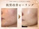ザ ピーチ(THE PEACH)の写真