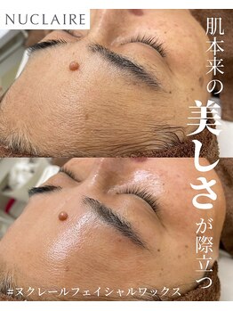 ここはなの写真/お顔の産毛が気になる方へ♪【フェイシャル脱毛ワックス(90分）￥10,800→￥8,800】トーンアップ効果も◎