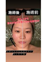 トリニティ 横浜店(TRINITY)/たった10分で！