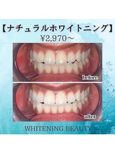 ホワイトニングビューティー つくば店/30分で人生変わります。