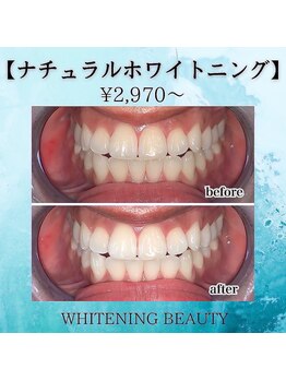 ホワイトニングビューティー つくば店/30分で人生変わります。