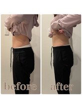 ファビー(Fabby)/マグフォース1回のビフォアフ