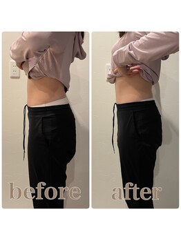 ファビー(Fabby)/マグフォース1回のビフォアフ