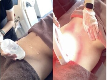 バンクスパ(BANK SPA)/人気のVIO脱毛もスピーディー♪