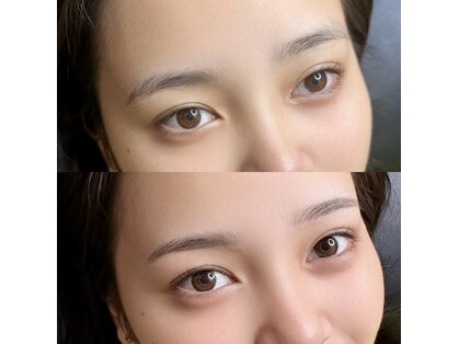 ビスチェ(VISCHE)の写真
