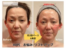 ポノ 甲府本店(pono)/頭蓋骨矯正ハーブトリートメント