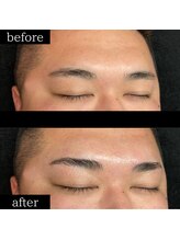 ユー 千葉駅前店(you)/ビフォーアフター写真