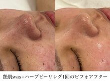 リフコウベ(LIF KOBE)