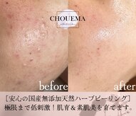 シュエマ(CHOUEMA)