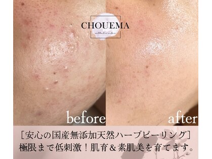 シュエマ(CHOUEMA)の写真