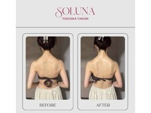 ソルナ 福岡薬院店(SOLUNA)/【１回での変化】