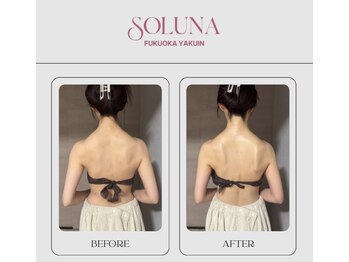 ソルナ 福岡薬院店(SOLUNA)/【1回での変化】
