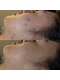 アルト(ALTO)の写真/年齢サインにアプローチ!色素沈着最高級ハーブ仕様でシミ改善&たるみ・ハリ・つやケア◎