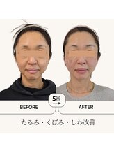 ふらっとエステ/コルギメンテナンスの力