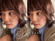 エクラ(Eclat)