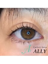 アリー(ALLY)/