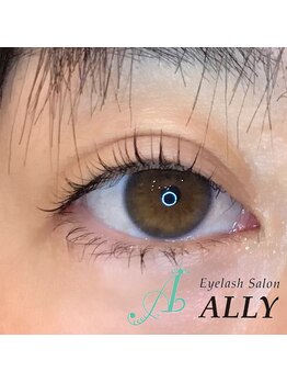 アリー(ALLY)/