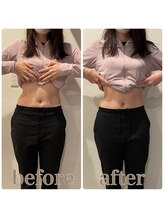 ファビー(Fabby)/マグフォース1回のビフォアフ