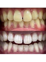 イイハキューブ(e8 cube)/before & after