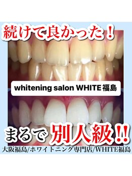 ホワイトニングサロン ホワイト(WHITE)/