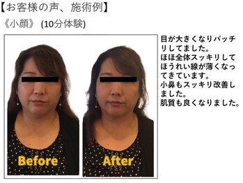江坂回復アップラボ/お客様の声、施術例