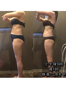 カルム エ コンポーゼ(Calme et Compose')/痩身セルゼロ/上半身6回