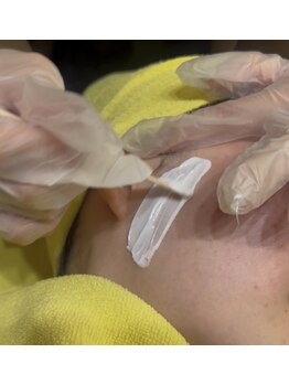 トータルビューティーステーションルンルン(RunRun)の写真/フェイスWAXで産毛まで☆至近距離でも自信がつくお肌に♪初めての方にもおすすめ！完全個室でリラックス◎