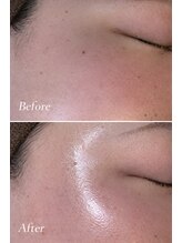 フォクシーワックス 立川店(FOXY WAX)/フェイシャルワックス