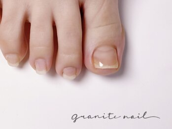 グラニットネイル(granite nail)の写真/韓国で特許を取得した巻き爪専用ジェル『HeySwitch』を使用!