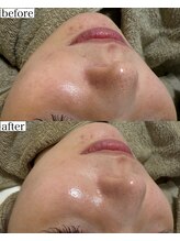 モンクラッシー(Mon classy)/