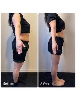 ストルツ(STOLZ)/2ヶ月で体脂肪7%の変化!